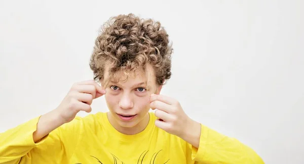 10代の男の子は電話を見ながらにきびを絞る 十代のにきびの問題 — ストック写真