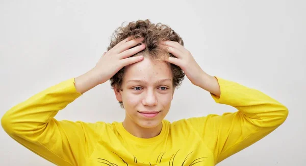 Teenage Boy Squeezes Acne While Looking Phone Problem Teenage Acne — Stock Photo, Image