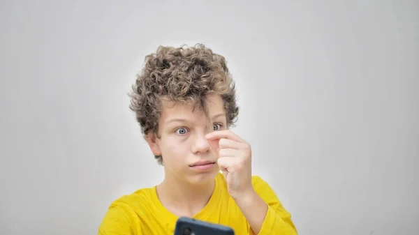 Teenager Squeezes Pimples While Looking Phone Problem Teenage Acne — Zdjęcie stockowe