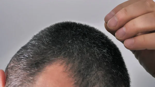 Male hair - close-up side view with gray hair, male hands touching head and hair.
