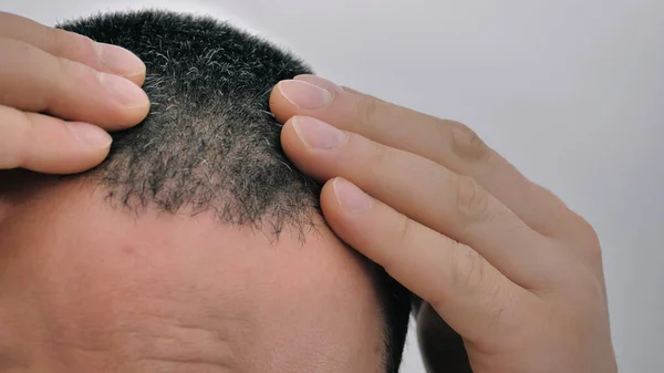 Muž Dotýká Svých Vlasů Šedými Vlasy — Stock fotografie