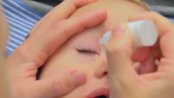 Una Madre Infonde Gocce Medicinali Nell Occhio Dei Bambini Trattare — Video Stock