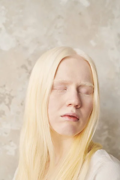 Jonge Albino Vrouw Met Een Bleke Huid Zeer Mooi Haar — Stockfoto