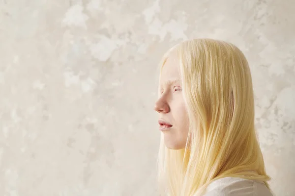 Vista Lateral Joven Mujer Bonita Con Albinismo Pie Frente Cámara — Foto de Stock