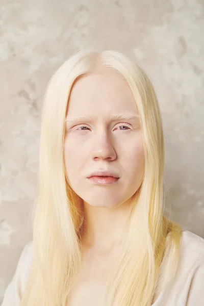 Adolescente Albino Menina Com Cabelos Longos Lisos Posando Frente Câmera — Fotografia de Stock