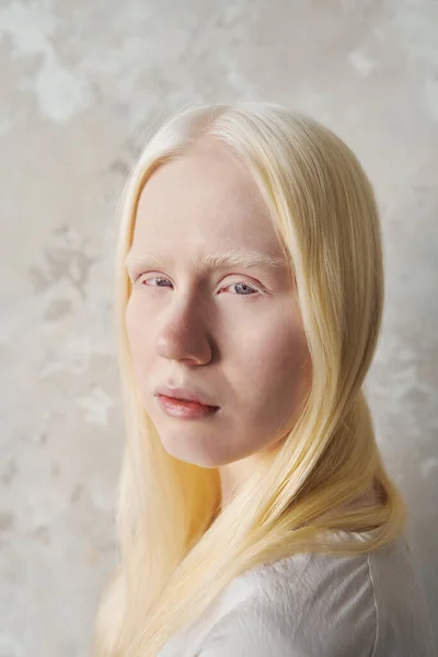 Makyajsız Genç Güzel Bir Albino Kadın Mermer Duvarın Üzerinde Durup — Stok fotoğraf