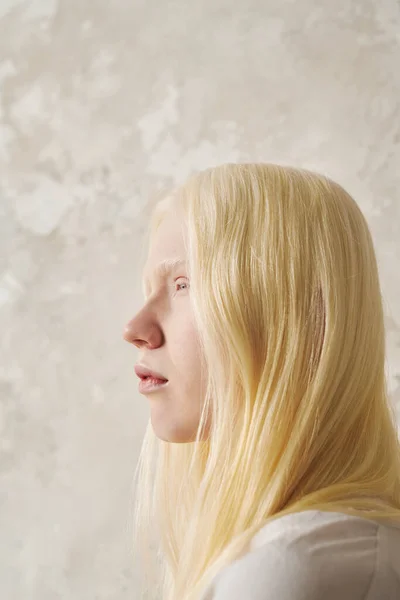 Молодая Спокойная Альбиноса Женщина Гладкими Длинными Волосами Смотрит Вперед Стоя — стоковое фото