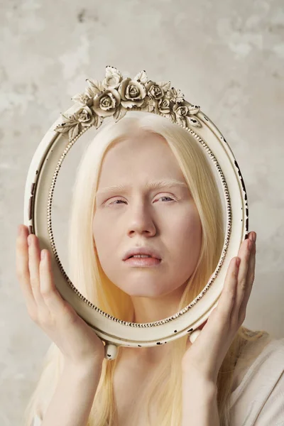 Face Young Serene Albino Woman Oval Antique Frame Decorated Roses — Stock Photo, Image