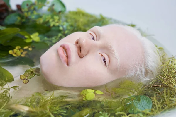 Junge Albino Frau Mit Blasser Haut Und Weißen Haaren Augenbrauen — Stockfoto