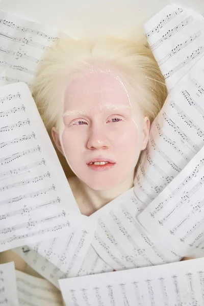 Powyżej Ujęcia Twarzy Albinoski Otoczonej Muzyką Nutami Nowego Arcydzieła Leżącego — Zdjęcie stockowe