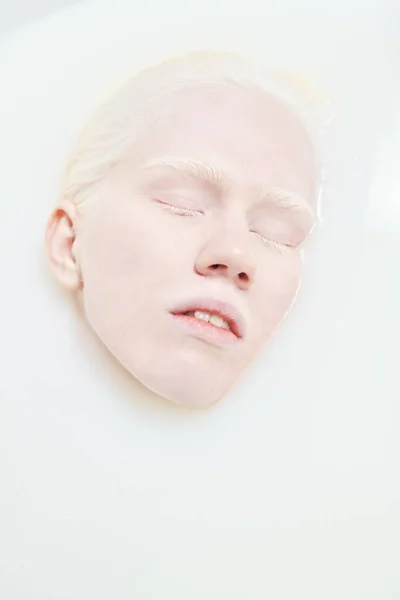 Plan Jeune Femme Albinos Détendue Gardant Les Yeux Fermés Tout — Photo