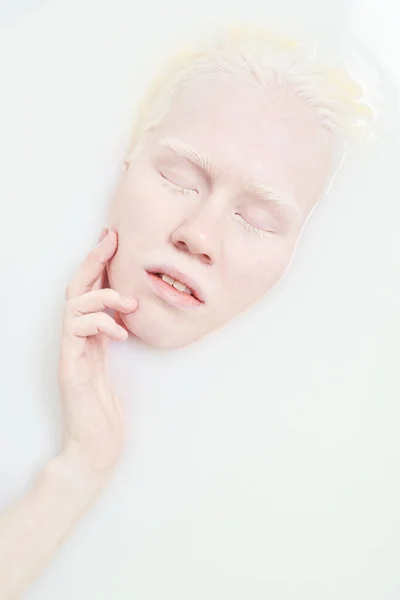 Vue Dessus Paisible Adolescente Albinos Fille Toucher Son Visage Tout — Photo