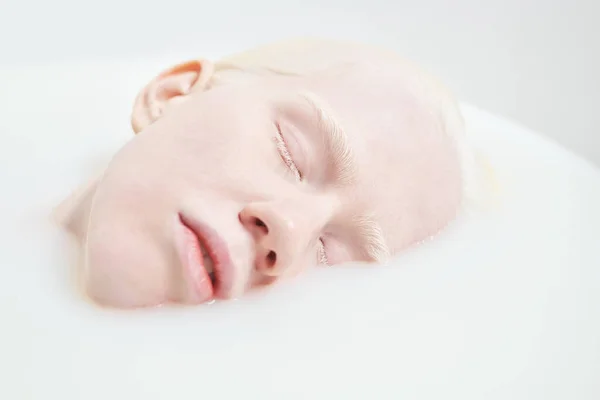 Deel Van Gezicht Van Rustig Slapend Albino Meisje Dat Haar — Stockfoto
