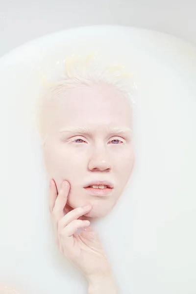 Junge Ruhige Albino Frau Ohne Make Gesicht Entspannt Sich Einer — Stockfoto