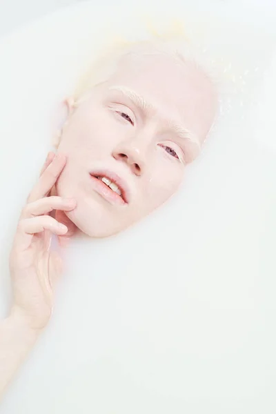 Gros Plan Sur Grand Angle Jeune Femme Albinos Qui Touche — Photo