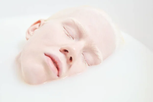 Close Pale Face Young Peaceful Sleeping Albino Woman Lying Bathtub — Stock Photo, Image