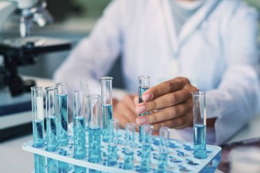 Laboratuvardaki özelliklerini incelemeden önce mavi sıvı maddeyle birlikte matara alan genç kadın farmakolojistin eli.