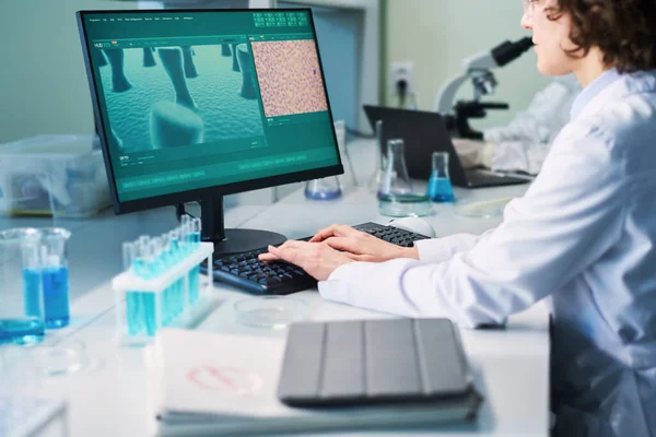 若い女性研究者は ウイルス細胞の一部を画面上にコンピュータモニタの前に座っている間 臨床実験を行います — ストック写真