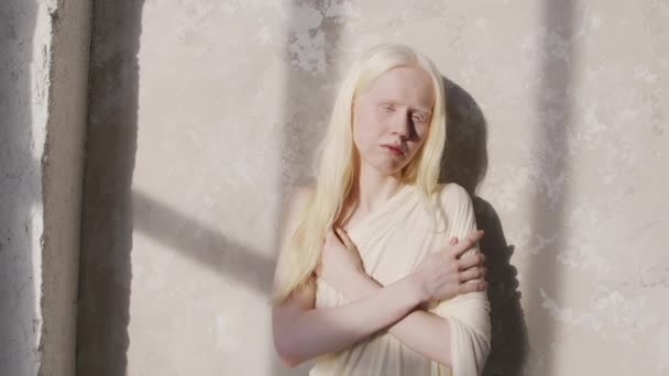 Retrato Médio Estúdio Jovem Albina Com Cabelos Longos Com Braços — Vídeo de Stock