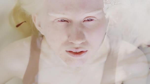 위에서 물고기와 물에서 Albinism와 여자의 클로즈업 초상화 — 비디오
