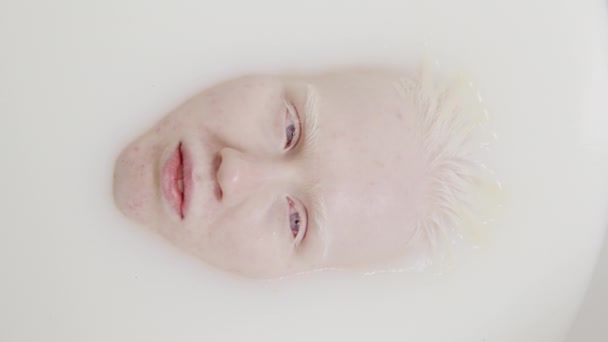 Top Close Belo Rosto Mulher Jovem Com Albinismo Enquanto Relaxa — Vídeo de Stock