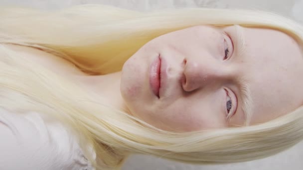 Pionowe Zbliżenie Studio Portret Młodej Białej Kobiety Albinizmem Zez Patrząc — Wideo stockowe