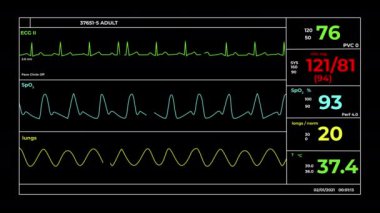 Hayati parametreleri izleyen entegre sistemli tıbbi ekipman ekranının CGI videosu