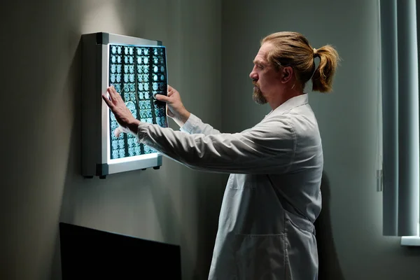 Oncólogo Masculino Experimentado Labcoat Que Mira Exploración Cerebral Del Después — Foto de Stock