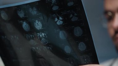 Beyin MR taramasını elinde tutan ve klinikte deşifre eden bulanık radyolojistin yakın plan görüntüsü.
