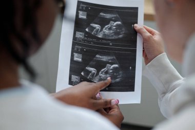 Bebek gelişimini gösteren ve sağlık durumunu gösteren doğum öncesi kontroller sırasında ultrason görüntülerini gösteren ve görünürde hiçbir tıbbi cihaz olmadan sağlık hizmetleri uzmanı tarafından tutulması ve izlenmesi