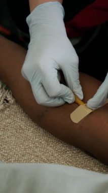 Hastanın damar içi serumu uygulamadan önce kateteri hastanın koluna bantla tutturan eldivenli sağlık görevlisinin dikey yakın çekimi.