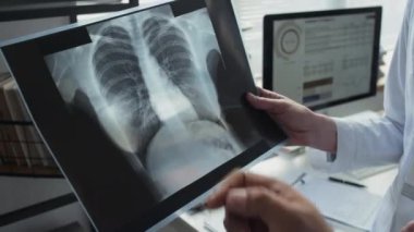 Meçhul erkek ve kadın doktorların göğüs röntgenini gösterip modern tıp ofisinde dururken teşhisi tartıştıkları ellere yakından bakın.