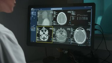 Beyaz önlüklü kadın radyoloji uzmanının bilgisayar ekranında beyin PET taramasını incelerken, yaralanma ya da dejeneratif hastalık teşhisi koyarken, semptomları ararken omuz üstü çekimleri.