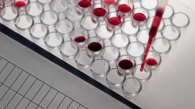 Tanınmayan laboratuar asistanının plastik test plakasındaki kuyulara kan damlattığı ve panoya iliştirilmiş verilerin işaretlendiği aşırı yakın plan görüntüsü.