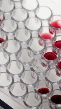 Kan ve pano dolu birkaç kuyu ile test plakası dikey makro görünümü Kimya verileri içeren tıbbi belge içeren