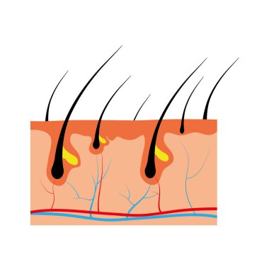 İnsan saç diyagramının vektör çizimi. Bir parça insan derisi ve beyaz arka plandaki tüm kıllar. Kelliğin tıbbi tedavisi, tüy temizleme konsepti.