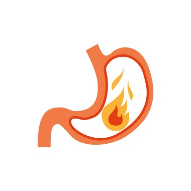 Karşılaştırmalı sağlıklı ve hastalıklı mide seti. Tıbbi vektör çizimi. Karın ağrısı, mide iltihabı, mide yanması. Beyaz zemin üzerinde ateş olan insan organı.