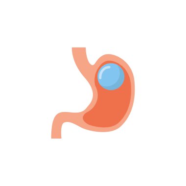Gastrik balon kilo kaybı intragastrik ameliyat. Mide balonu işlem vektörü simgesi