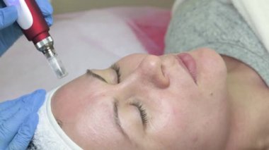 Shot of beautician doing dermapen mesotherapy injection on face for rejuvenation in spa, 4k video.