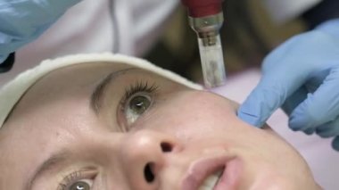 Shot of beautician doing dermapen mesotherapy injection on face for rejuvenation in spa, 4k video.