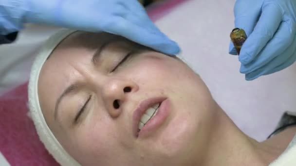 Ampoule Vitamin Application Directly Face Procedure Mesotherapy Help Dermapen Application — Stock video