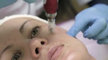 Shot of beautician doing dermapen mesotherapy injection on face for rejuvenation in spa, 4k video.