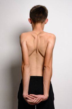 Tişörtsüz ergen bir çocuğun kollarını arkadan sıktığını gördüm. Koyu renk atletik şort giyiyor. Görüntü basit ve temiz, sağlık, zindelik veya tıbbi bağlamlar için idealdir..