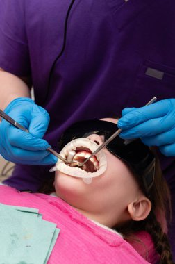Dişçi dişleri üzerinde dikkatlice çalışırken, siyah gözlük takan bir çocuk, iyi ışıklandırılmış bir klinik ortamında nazik bir yaklaşım sergiliyor..