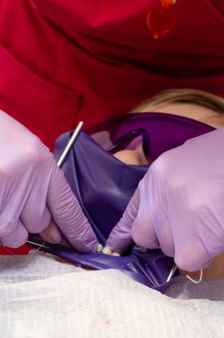 Uzman diş hekimi, tipik bir randevu sırasında hasta rahatlığı ve güvenliğini sağlarken özel tedavi araçları kullanır..