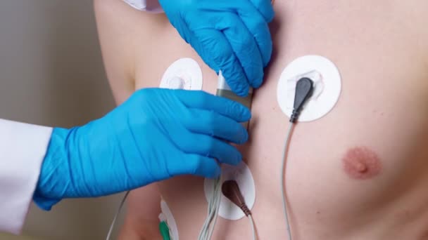 Médico Usa Dispositivo Holter Para Monitorar Eletrocardiograma Coração Peito Homem — Vídeo de Stock