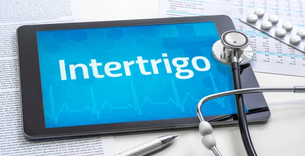 Ordet Intertrigo Displayen Tablett — Stockfoto