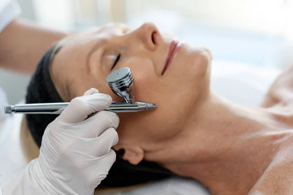 Biała Kobieta Otrzymuje Peeling Tlenu Centrum Kosmetologii Leczenie Twarzy Piękna — Zdjęcie stockowe