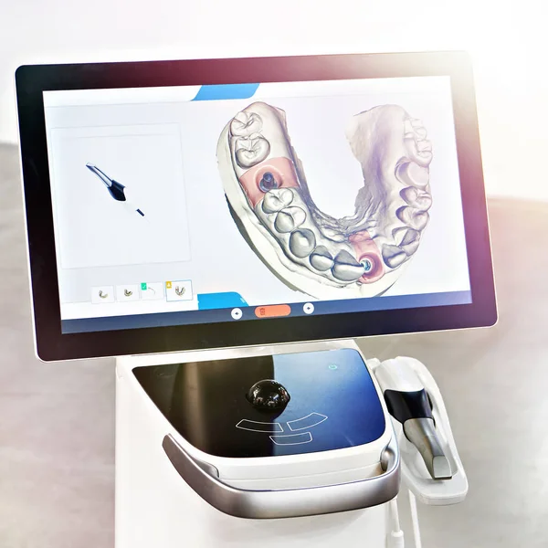 Dispositivo Dental Para Hacer Prótesis Dentales Perfectas — Foto de Stock