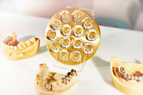 Vybavení Pro Umístění Zlaté Zubní Koruny — Stock fotografie